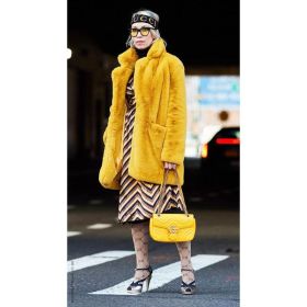Warm Temperament Leisure Baggy Coat (Option: Yellow-M)